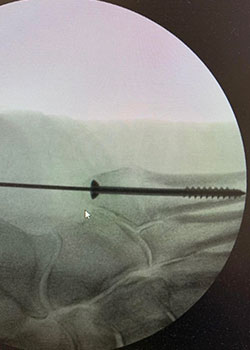 x-ray images