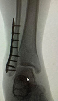 x-ray images