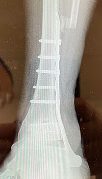 x-ray images