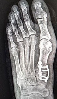 x-ray images