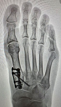 x-ray images