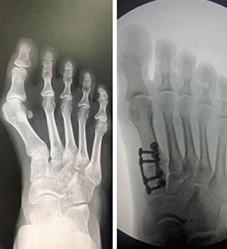 x-ray images
