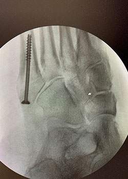 x-ray images