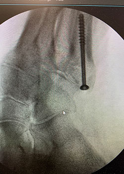 x-ray images