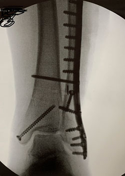 x-ray images